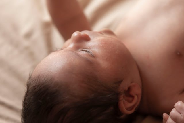 Baby acne-gevoelige huid