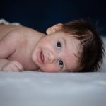 Baby met eczeem