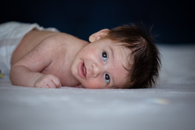 Baby met eczeem